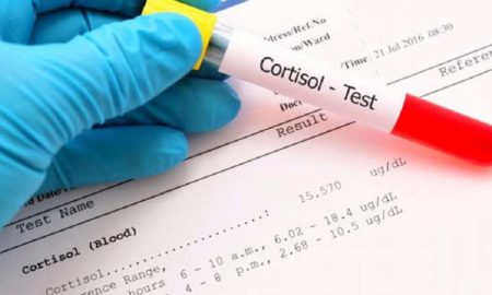 What a cortisol blood stress test reveals about your health.